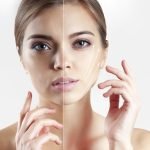 5 Wholesome Methods To Carry The Sagging Pores and skin On Face