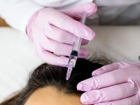 Mesotherapy For Hair Loss – Does It Work? Mesotherapy For Hair Loss – Does It Work?