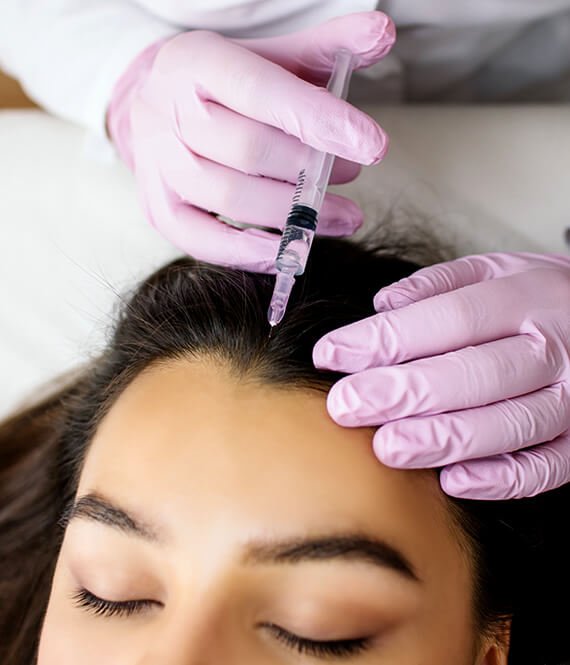 Mesotherapy For Hair Loss – Does It Work? Mesotherapy For Hair Loss – Does It Work?